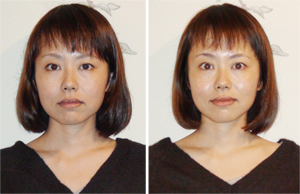 before-after