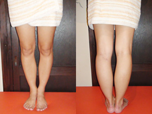 leg4